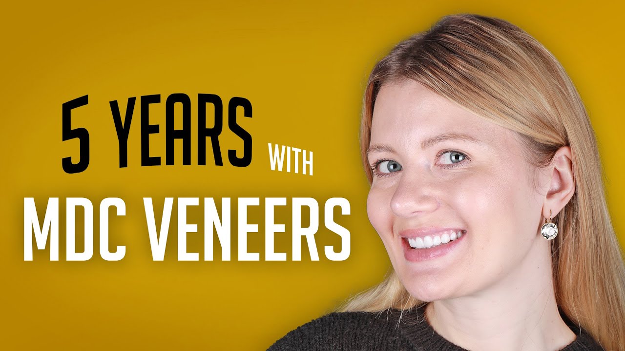 Maltepe Dental Clinic Reveals Minimal Prep Dental Veneers Dominate UK Patient Choices